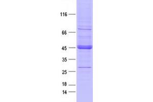 Western Blotting (WB) image for Discoidin Domain Receptor tyrosine Kinase 2 (DDR2) protein (DYKDDDDK Tag) (ABIN2713459)