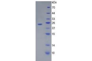 SDS-PAGE (SDS) image for Toll-Like Receptor 5 (TLR5) ELISA Kit (ABIN6730957)
