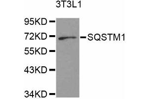Western blot analysis of extracts of 3T3-L1 cells, using SQSTM1 antibody. (SQSTM1 Antikörper)
