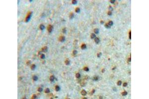 Used in DAB staining on fromalin fixed paraffin-embedded brain tissue (SRPK2 Antikörper  (AA 380-617))