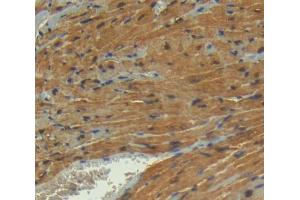 Immunohistochemistry (IHC) image for anti-phosphoglycerate Mutase 2 (Muscle) (PGAM2) (AA 1-236) antibody (ABIN5014094)