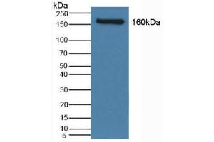 Western blot analysis of Human Serum. (SLC12A3 Antikörper  (AA 867-1024))