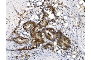 IHC analysis of VPRBP/DCAF1 using anti-VPRBP/DCAF1 antibody (ABIN7599063). (DDB1 and CUL4-Associated Factor 1 (DCAF1) (AA 1-195) Antikörper)