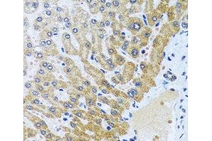 Immunohistochemistry of paraffin-embedded Human liver using CPA6 Polyclonal Antibody at dilution of 1:100 (40x lens). (CPA6 Antikörper)