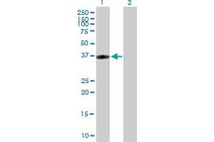 Western Blot analysis of CRHR2 expression in transfected 293T cell line by CRHR2 MaxPab polyclonal antibody. (CRHR2 Antikörper  (AA 1-411))