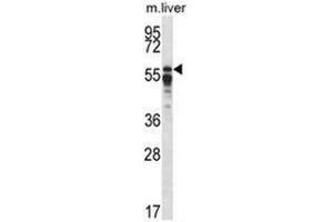 Western blot analysis of PPP2R5A Antibody (C-term) in mouse liver tissue lysates (35ug/lane). (PPP2R5A Antikörper  (C-Term))