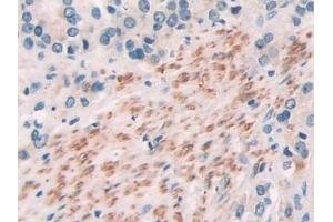 Immunohistochemistry (IHC) image for anti-Suppressor of Cytokine Signaling 2 (SOCS2) (AA 1-198) antibody (ABIN7443314)