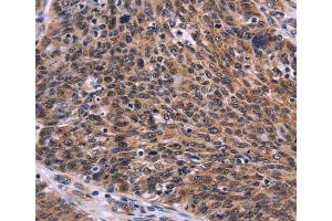 Immunohistochemistry (IHC) image for anti-CDC5 Cell Division Cycle 5-Like (S. Pombe) (CDC5L) antibody (ABIN2828386) (CDC5L Antikörper)