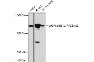 Western blot analysis of extracts of various cell lines, using p90Rsk/RSK1/RPS6K Rabbit mAb (ABIN1681116, ABIN3019149, ABIN3019150 and ABIN7101723) at 1:1000 dilution.