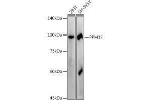 Western blot analysis of extracts of various cell lines, using (ABIN7269695) at 1:1000 dilution. (PPM1E Antikörper)