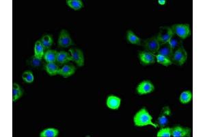 Immunofluorescent analysis of A431 cells using ABIN7164606 at dilution of 1:100 and Alexa Fluor 488-congugated AffiniPure Goat Anti-Rabbit IgG(H+L) (SLC38A6 Antikörper  (AA 132-169))