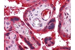 Human Placenta: Formalin-Fixed, Paraffin-Embedded (FFPE) (C9 Antikörper)