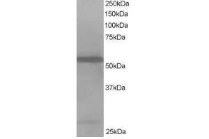 Image no. 1 for anti-Drebrin-Like (DBNL) (N-Term) antibody (ABIN374214) (DBNL Antikörper  (N-Term))