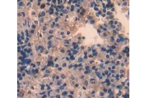 IHC-P analysis of Kidney tissue, with DAB staining. (STAP1 Antikörper  (AA 1-297))
