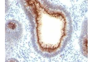 Image no. 1 for anti-Carcinoembryonic Antigen-Related Cell Adhesion Molecule 5 (CEACAM5) antibody (ABIN6151894) (CEACAM5 Antikörper)