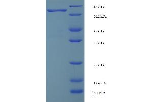SDS-PAGE (SDS) image for SMAD Specific E3 Ubiquitin Protein Ligase 2 (SMURF2) (AA 1-748), (full length) protein (GST tag) (ABIN5711831)