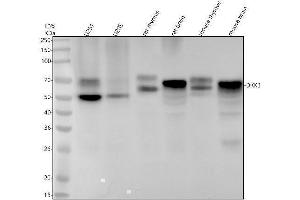 Western blot analysis of DKK3 using anti-DKK3 antibody (ABIN7604650).