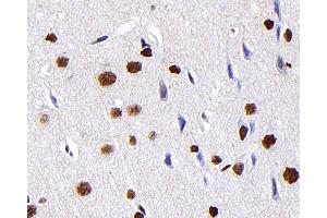 Immunohistochemistry analysis of paraffin-embedded Rat brain using S100A4 Monoclonal Antibody at dilution of 1:300. (s100a4 Antikörper)