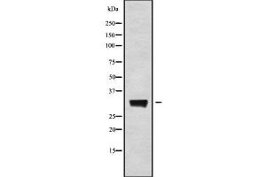 Western blot analysis of KCNMB3 using A549 whole cell lysates