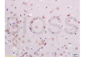 Formalin-fixed and paraffin embedded rat brain labeled with Anti-PAX3 Polyclonal Antibody, Unconjugated (ABIN737616) at 1:200 followed by conjugation to the secondary antibody and DAB staining (Paired Box 3 Antikörper  (AA 151-250))