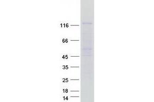 Western Blotting (WB) image for Hermansky-Pudlak Syndrome 5 (HPS5) (Transcript Variant 2) protein (Myc-DYKDDDDK Tag) (ABIN2723039)