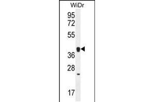 Western blot analysis in WiDr cell line lysates (35ug/lane). (OR2T8 Antikörper  (C-Term))