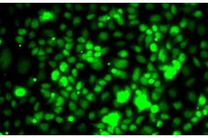 Immunofluorescence analysis of MCF7 cells using TCEB3 Polyclonal Antibody (TCEB3 Antikörper)
