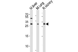 Western blot analysis of lysates from mouse liver, mouse lung, rat kidney tissue lysate (from left to right), using SOST Antibody (N-term) (ABIN390193 and ABIN2840682). (Sclerostin Antikörper  (N-Term))
