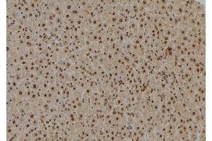 ABIN6277020 at 1/100 staining Mouse liver tissue by IHC-P. (TAF9 Antikörper  (Internal Region))