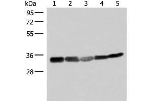 Western blot analysis of 293T HepG2 and A549 cell lysates using ECH1 Polyclonal Antibody at dilution of 1:200 (ECH1 Antikörper)