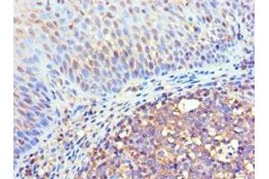 Immunohistochemistry of paraffin-embedded human tonsil tissue using ABIN7152969 at dilution of 1:100 (Flotillin 2 Antikörper  (AA 239-428))