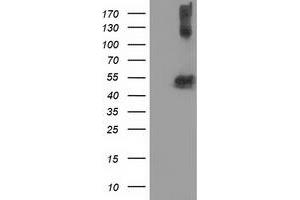 Western Blotting (WB) image for anti-Tubulin beta 4a (TUBB4A) antibody (ABIN1501580)