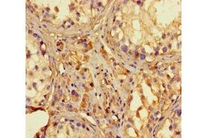 Immunohistochemistry of paraffin-embedded human testis tissue using ABIN7142130 at dilution of 1:100 (RNASEL Antikörper  (AA 330-741))