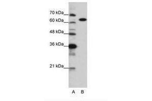 Image no. 1 for anti-Lysyl-tRNA Synthetase (KARS) (C-Term) antibody (ABIN6749717)