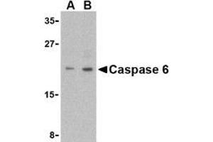 Western blot analysis of Caspase-6 in MCF7 cell lysate with AP30201PU-N Caspase-6 antibody (IN) at (A) 1 and (B) 2 μg/ml. (Caspase 6 Antikörper  (Intermediate Domain))