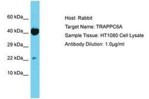 Image no. 1 for anti-Trafficking Protein Particle Complex 6A (TRAPPC6A) (AA 21-70) antibody (ABIN6750666) (TRAPPC6A Antikörper  (AA 21-70))