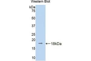 Western blot analysis of the recombinant protein. (KIF5A Antikörper  (AA 473-605))