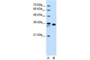 AKR1B1 antibody used at 1. (AKR1B1 Antikörper)