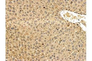 ABIN6257431 and ABIN6275975 at 1/100 staining Rat liver tissue by IHC-P. (PTH1R Antikörper  (Internal Region))