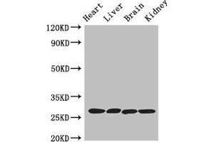 Western Blot Positive WB detected in: Mouse heart tissue, Mouse liver tissue, Mouse brain tissue, Mouse kidney tissue All lanes: PRSS2 antibody at 3 μg/mL Secondary Goat polyclonal to rabbit IgG at 1/50000 dilution Predicted band size: 27 kDa Observed band size: 27 kDa