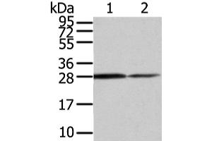 Western Blot analysis of Mouse stomach and Human fetal muscle tissue using RHOU Polyclonal Antibody at dilution of 1/200 (RHOU Antikörper)