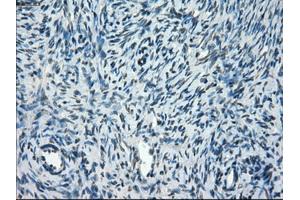 Immunohistochemical staining of paraffin-embedded colon tissue using anti-TMEM100mouse monoclonal antibody. (TMEM100 Antikörper)