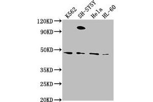 Western Blot Positive WB detected in: K562 whole cell lysate, SH-SY5Y whole cell lysate, Hela whole cell lysate, HL-60 whole cell lysate All lanes: RTN4RL2 antibody at 1:2000 Secondary Goat polyclonal to rabbit IgG at 1/50000 dilution Predicted band size: 47, 22 kDa Observed band size: 47 kDa (RTN4RL2 Antikörper  (AA 355-372))