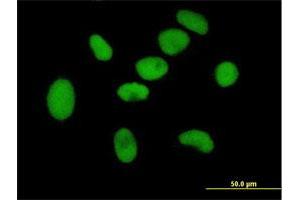 Immunofluorescence of purified MaxPab antibody to ZNF189 on HeLa cell. (ZNF189 Antikörper  (AA 1-584))