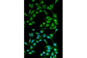 Immunofluorescence analysis of MCF7 cell using ICOS antibody. (ICOS Antikörper  (AA 21-140))
