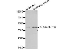 Western Blotting (WB) image for anti-Forkhead Box O4 (FOXO4) (pSer197) antibody (ABIN1870198) (FOXO4 Antikörper  (pSer197))