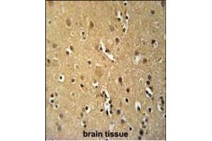 Immunohistochemistry (Paraffin-embedded Sections) (IHC (p)) image for anti-Tumor Necrosis Factor Receptor Superfamily, Member 8 (TNFRSF8) (AA 458-487) antibody (ABIN651104)