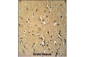 TNFRSF8- Antibody (ABIN651104 and ABIN2840072) immunohistochemistry analysis in formalin fixed and paraffin embedded human brain tissue followed by peroxidase conjugation of the secondary antibody and DAB staining.