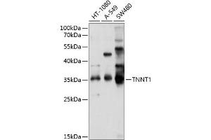 Western blot analysis of extracts of various cell lines, using TNNT1 antibody (ABIN6127683, ABIN6149363, ABIN6149364 and ABIN6214579) at 1:1000 dilution. (TNNT1 Antikörper  (AA 1-262))
