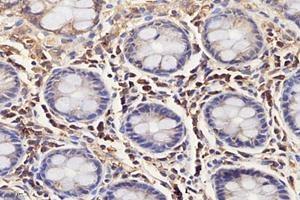 Immunohistochemistry analysis of paraffin-embedded human colon using,IL-3RB (ABIN7073557) at dilution of 1: 4000 (CD131 Antikörper)